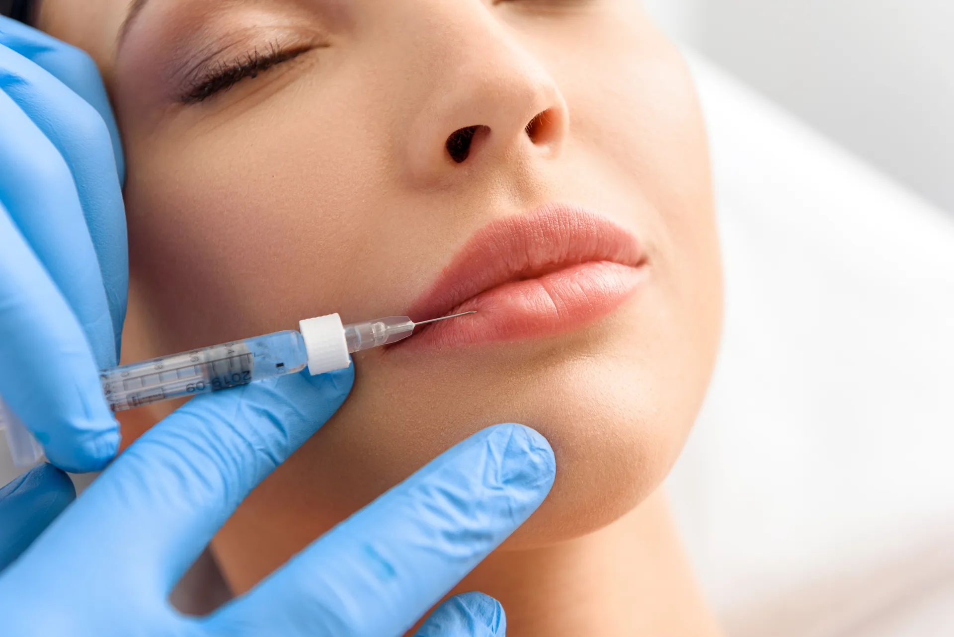 Hyaluronic Acid Fillers in Los Angeles