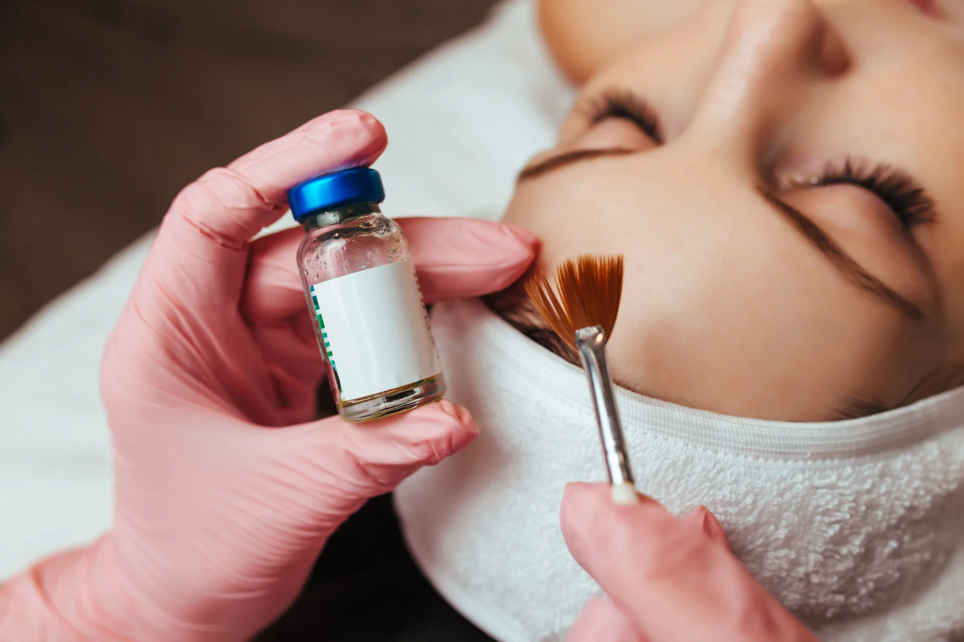 Medical Grade Peels in Los Angeles